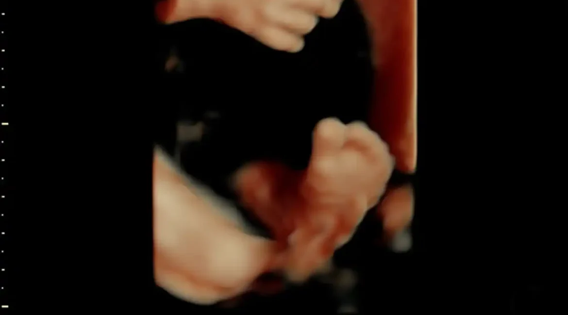 3d-echo-2